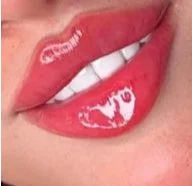 Monthly Membership • 1.0 mL Lip Filler 💋 (Pricing)