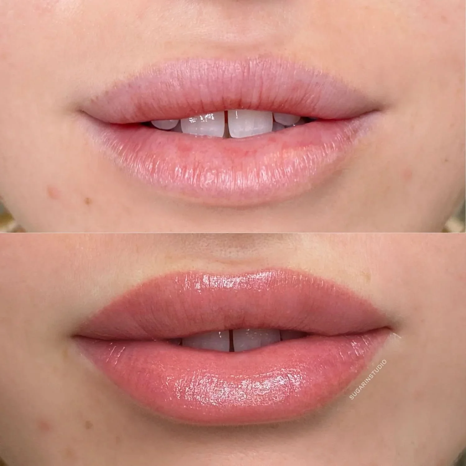 Close-up of a person's lips, showing a before-and-after comparison of lip makeup or gloss application, with the top image displaying natural lips and the bottom image showing enhanced, glossy lips.