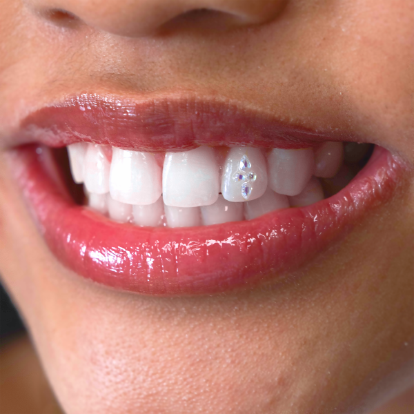 Close-up of a person's smile showing their teeth and lips with shiny lip gloss and a small decorative jewel on their upper lip.