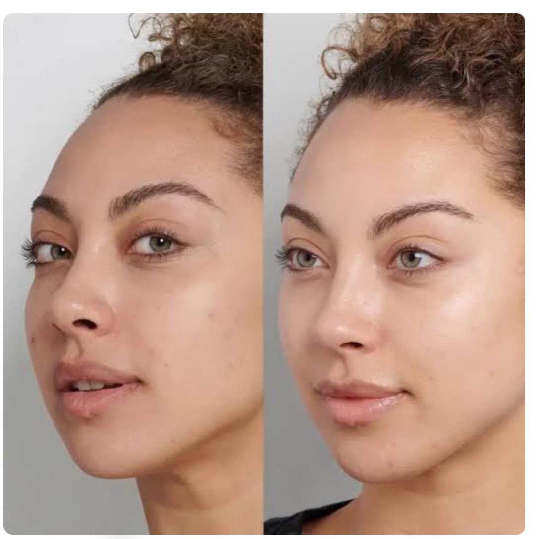 Dermaplane Glow Facial