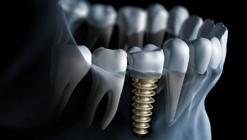 Four Season Dentistry: Daniel Malan Dmd