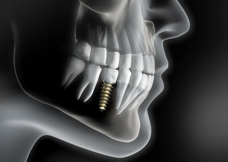 Four Season Dentistry: Daniel Malan Dmd