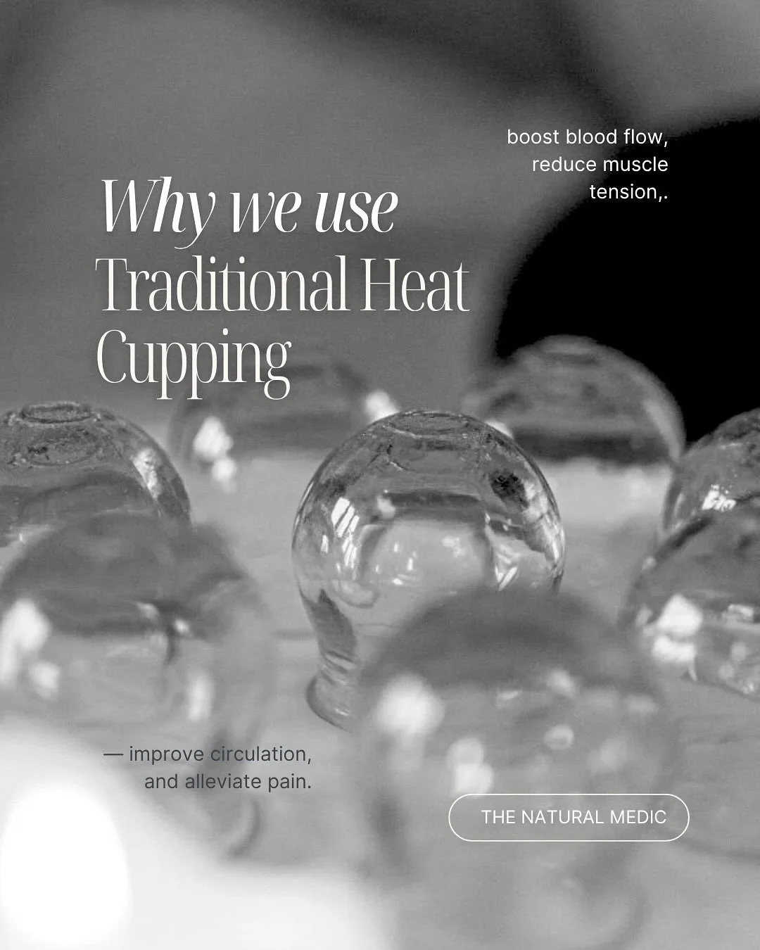 An ancient practice in Chinese medicine that goes deeper than just relieving muscle tension.

Book your 45min consultation &amp; treatment introductory offer for $59 via link in bio or send us a message 

.
.
#naturalmedic #varsitylakes #goldcoast  #