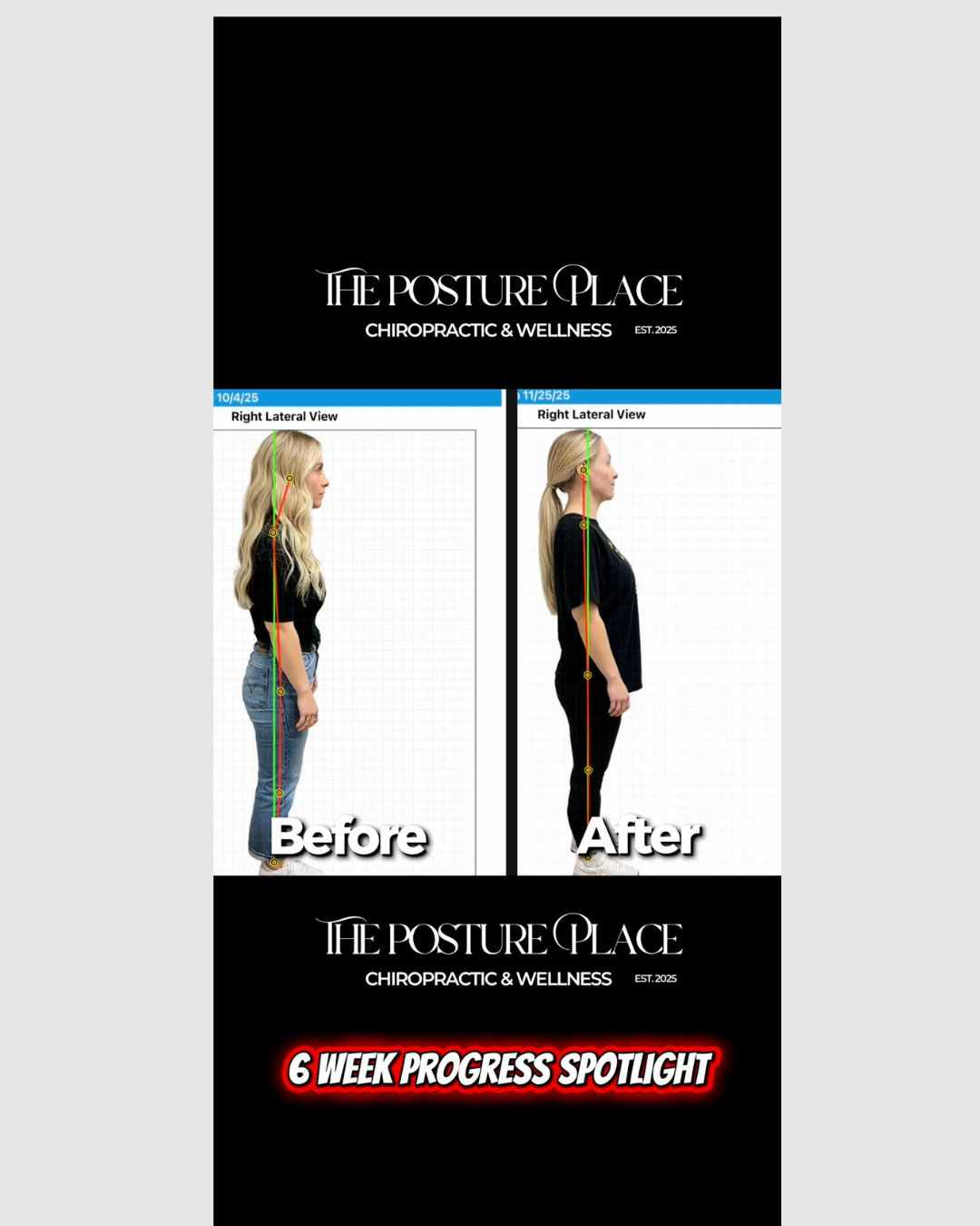 T levis progress posture photo.png