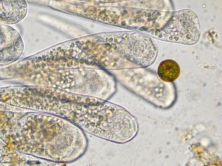 Peritrich ciliates (I&rsquo;m thinking probably Epistylis sp. but I haven&rsquo;t spent much time IDing this). 100x magnification. Brightfield microscopy.
.
Here you can see a close up of a small colony of peritrich ciliates and a euglenid (Trachelom
