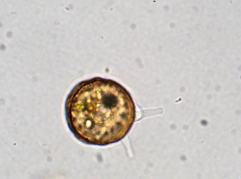Testate amoeba (Arcella sp). 100x magnification. Brightfield microscopy. Speed 3x.
.
Usually when we think of amoebas we think of amorphous single cells creeping around our microscope slides. This is still the case for testate aboebae like Arcella, h