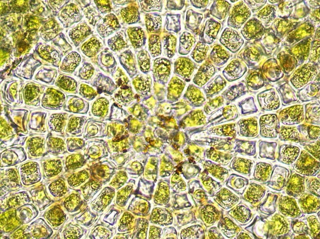 Coleochaete algae! 100x magnification. Brightfield.
.
I am so excited to post this. I&rsquo;ve always wanted to photograph Coleochaetes and thanks to @polarblairx it&rsquo;s finally happened! We went for a little hike in the Great Swamp wildlife refu