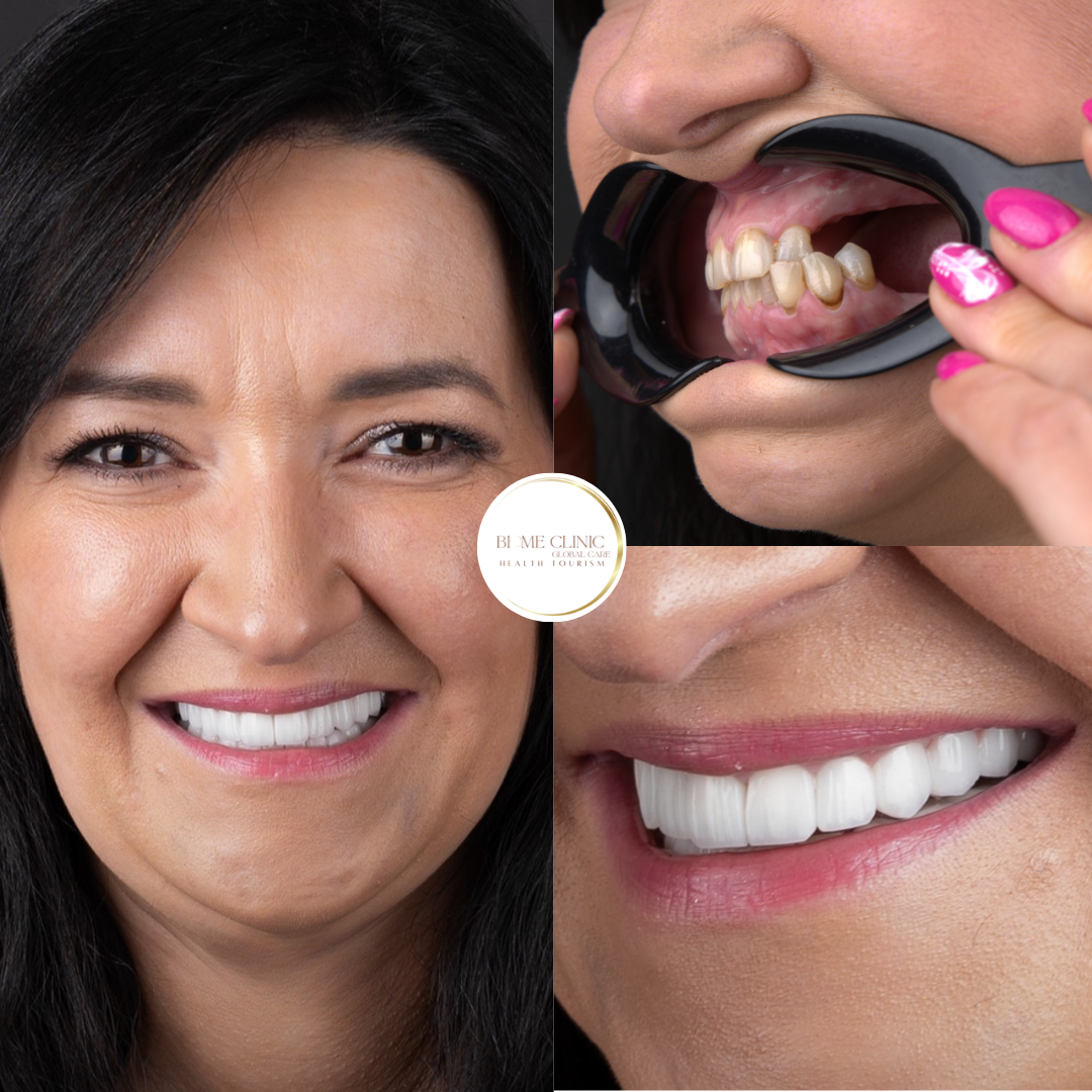 White Beige Aesthetic Minimalist Photo Collage Zoom Effect Instagram Reel (1080 x 1350 px).png