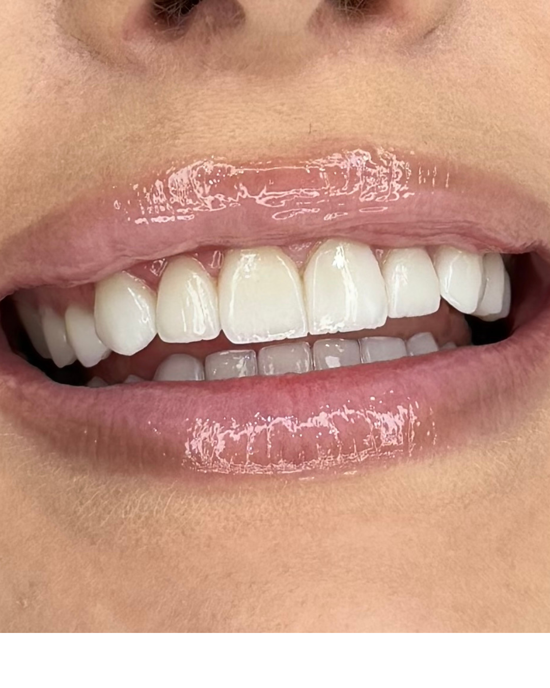 LÄÄKETIETEELLINEN MATKAILU.png