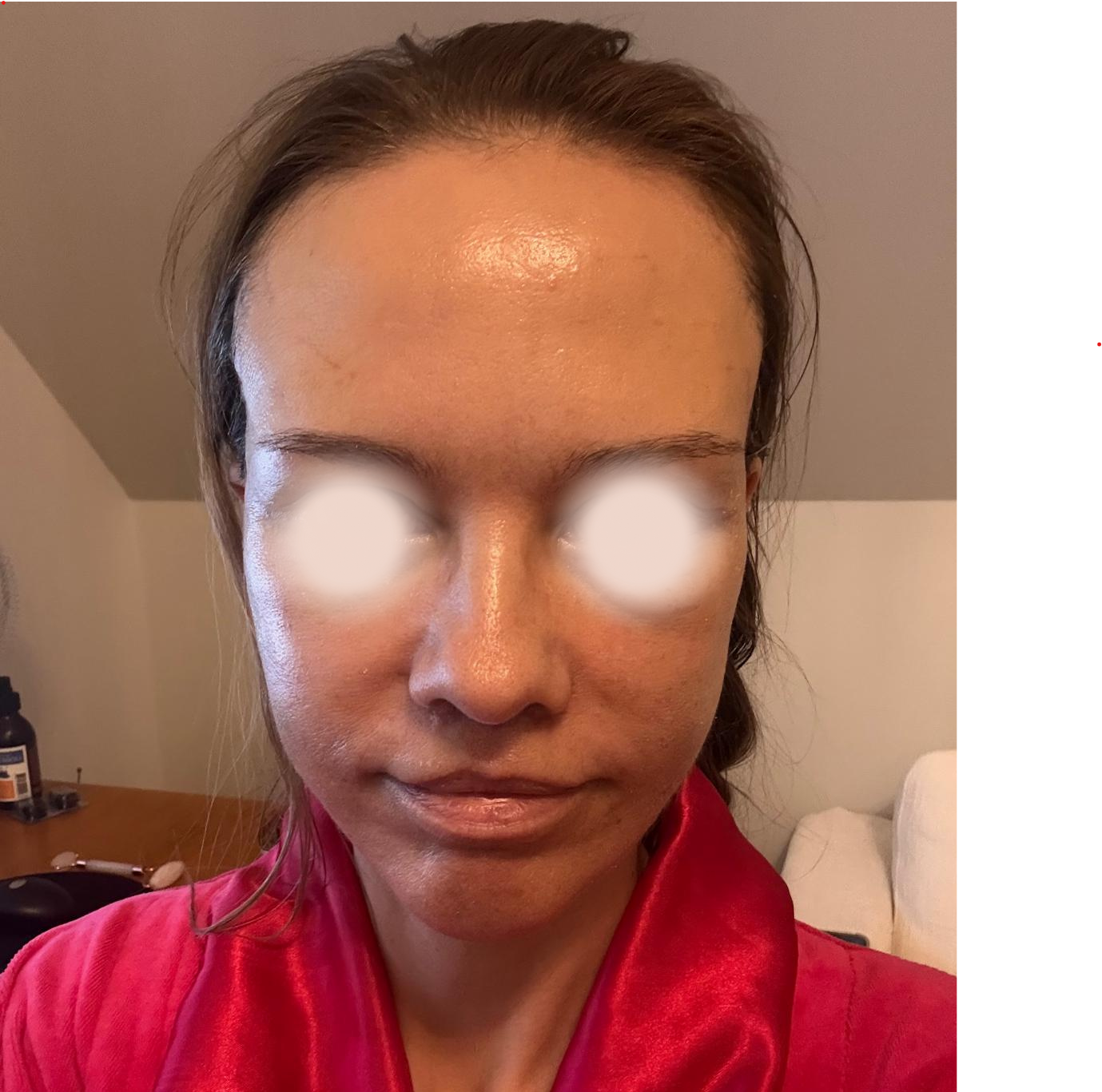       
  
    Facelift Istanbulissa: Marian kokemustarina  


  
 #block-4314ae63e4d2aabe211d {
    
    
    
  }

  #block-4314ae63e4d2aabe211d .sqs-html-content {
    
    }

  #block-4314ae63e4d2aabe211d {
      mix-blend-mode: var(--tweak-text-b