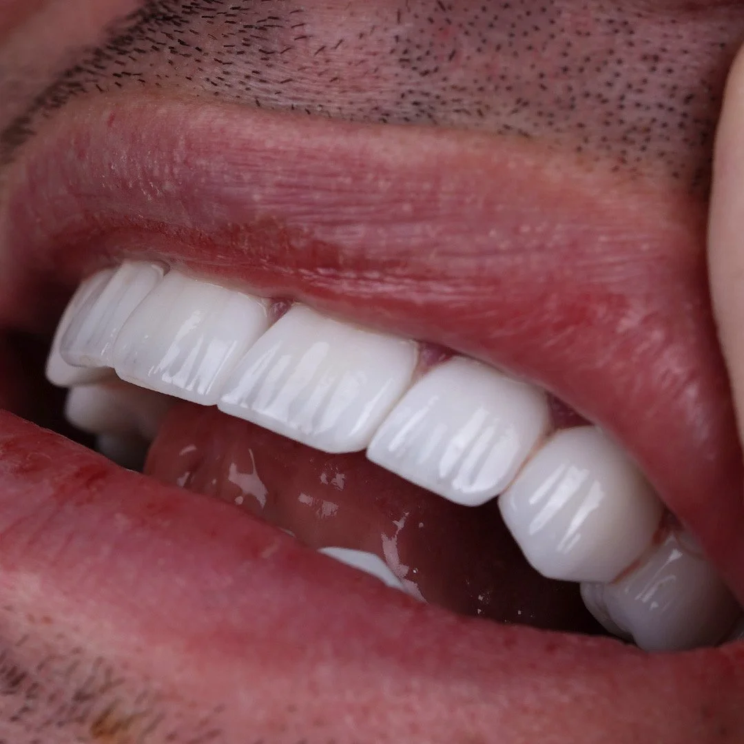 Ihmisen suu läheltä, näkyvissä hampaita ja kielen kärkeä.