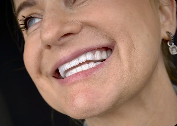 Ihminen hymyilee ja paljastaa hyvin hoidetut, valkoiset hampaat.