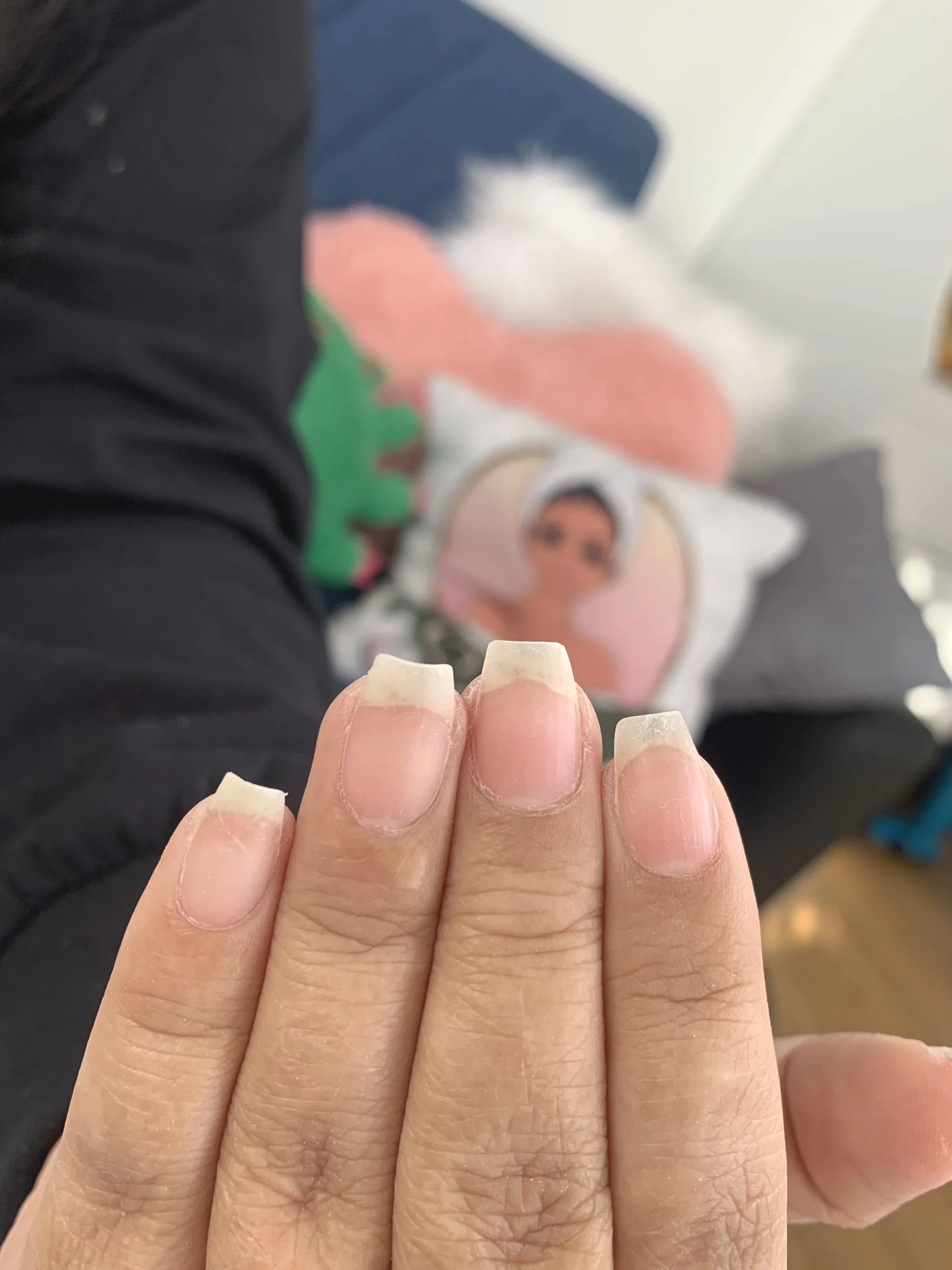 Why Dry Cuticles Cause Brittle Nails
