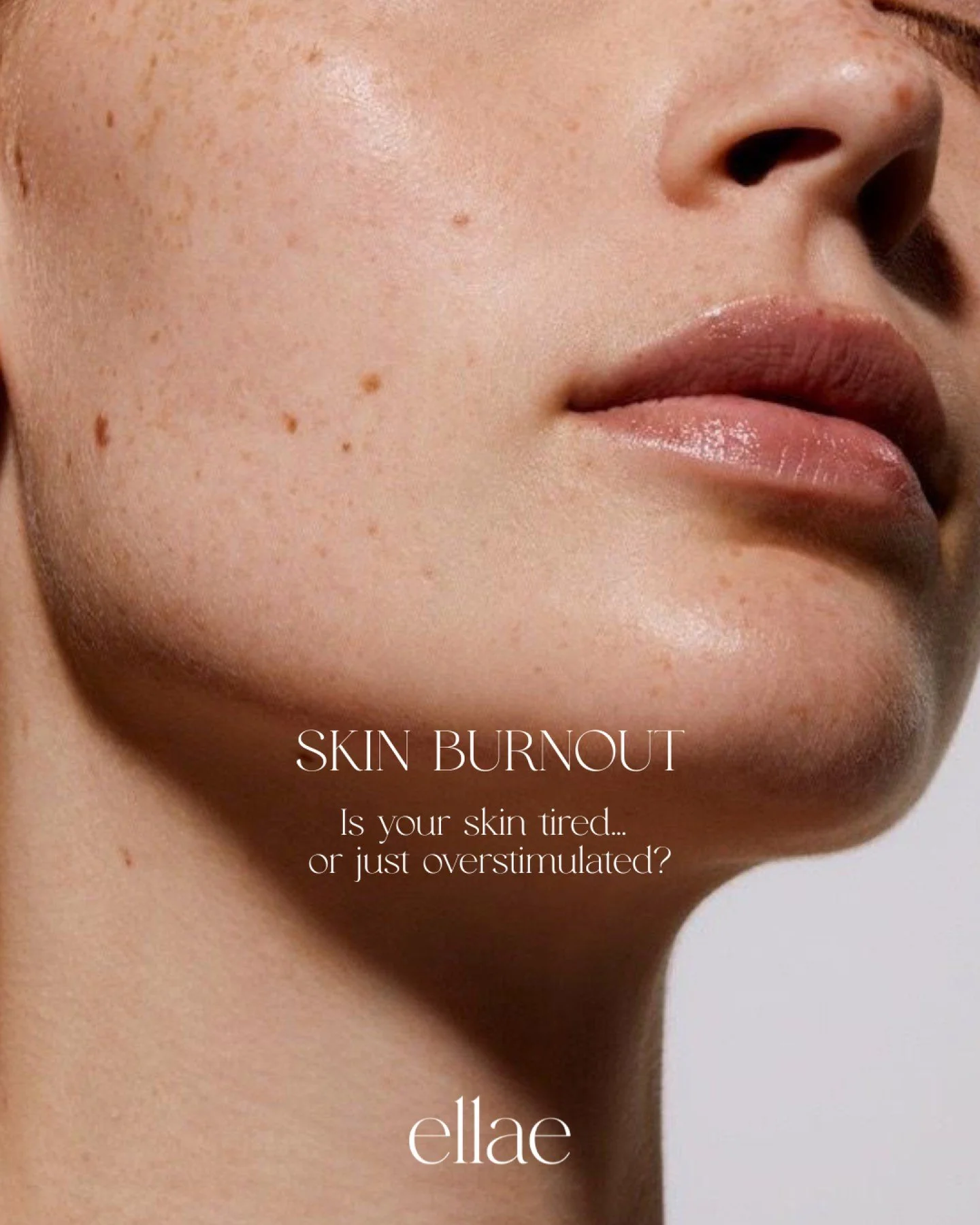 If your skin has been acting &ldquo;off&rdquo; lately you&rsquo;re not imagining it.

By this time of year we see it constantly. Flare ups that won&rsquo;t settle, pigment that suddenly looks darker, fine dehydration lines &amp; skin that just feels 