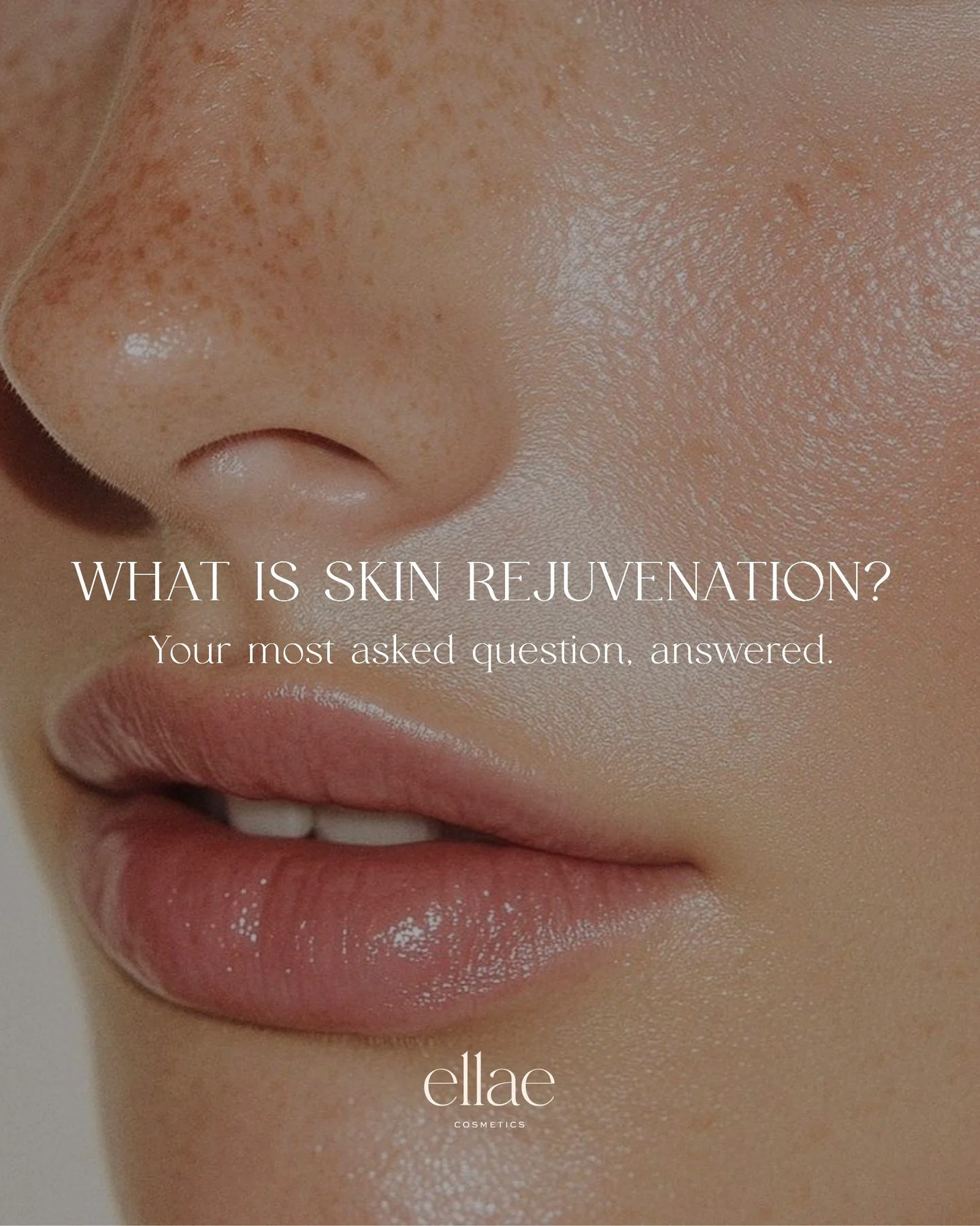 So, what does skin rejuvenation actually mean? 👀

It&rsquo;s one of the most common questions we get asked, and for good reason. Skin rejuvenation is all about restoring your skin&rsquo;s natural glow by improving texture, tone, and reducing imperfe