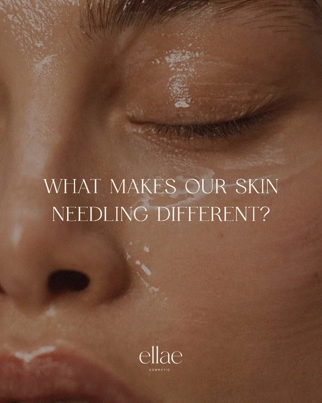 Think all skin needling is the same? 👀

The difference lies in the device and the technique. Lower-grade devices can drag across the skin, increasing irritation and compromising your skin barrier.

Our medical-grade device is designed to create clea