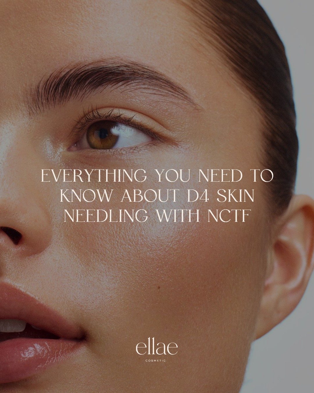 Here&rsquo;s why we love adding the NCTF skin booster to our skin needling treatments&hellip; SWIPE LEFT for the 411. 👀

Book now via the link in our bio. 🔗🤍

*All content on this page is for educational purposes only and does not constitute medic