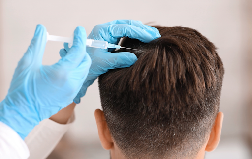 PRP vs Exosomes for Hair Loss: Can Regenerative Treatments Really Restore Hair Growth?