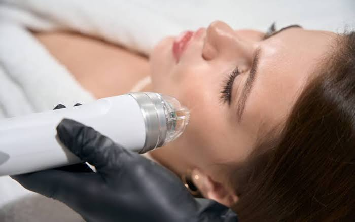 Microneedling in Summer: Can You Still Treat Your Skin Safely?