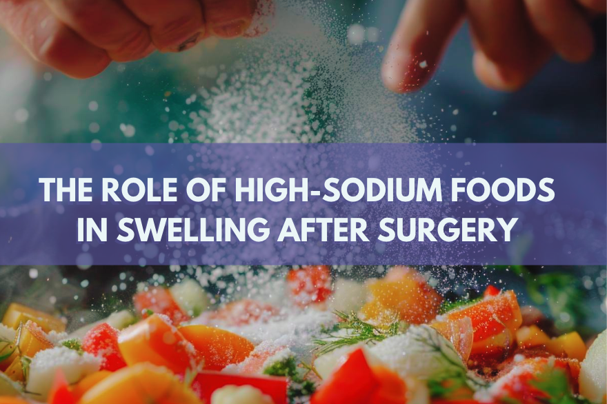 High-Sodium Foods and Their Impact on Swelling