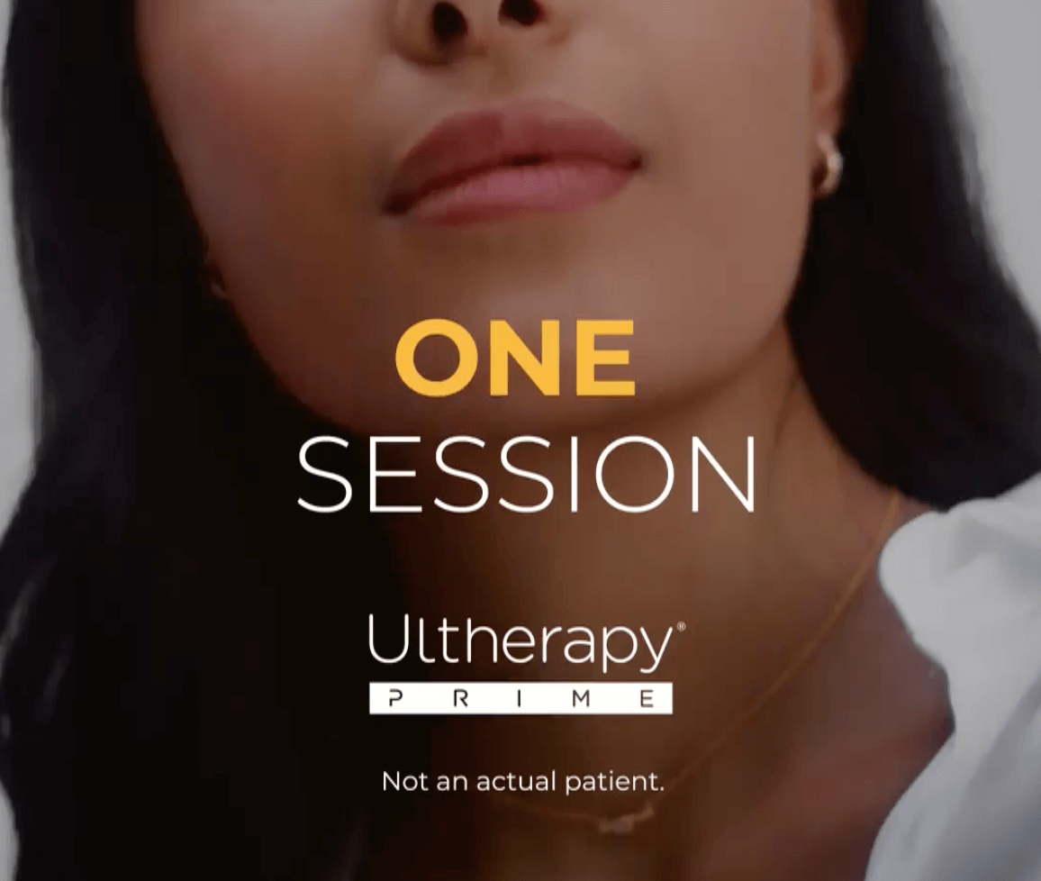 Close-up of a woman's face with text overlay promoting a one-session Ultherapy treatment, indicating it is not for an actual patient.