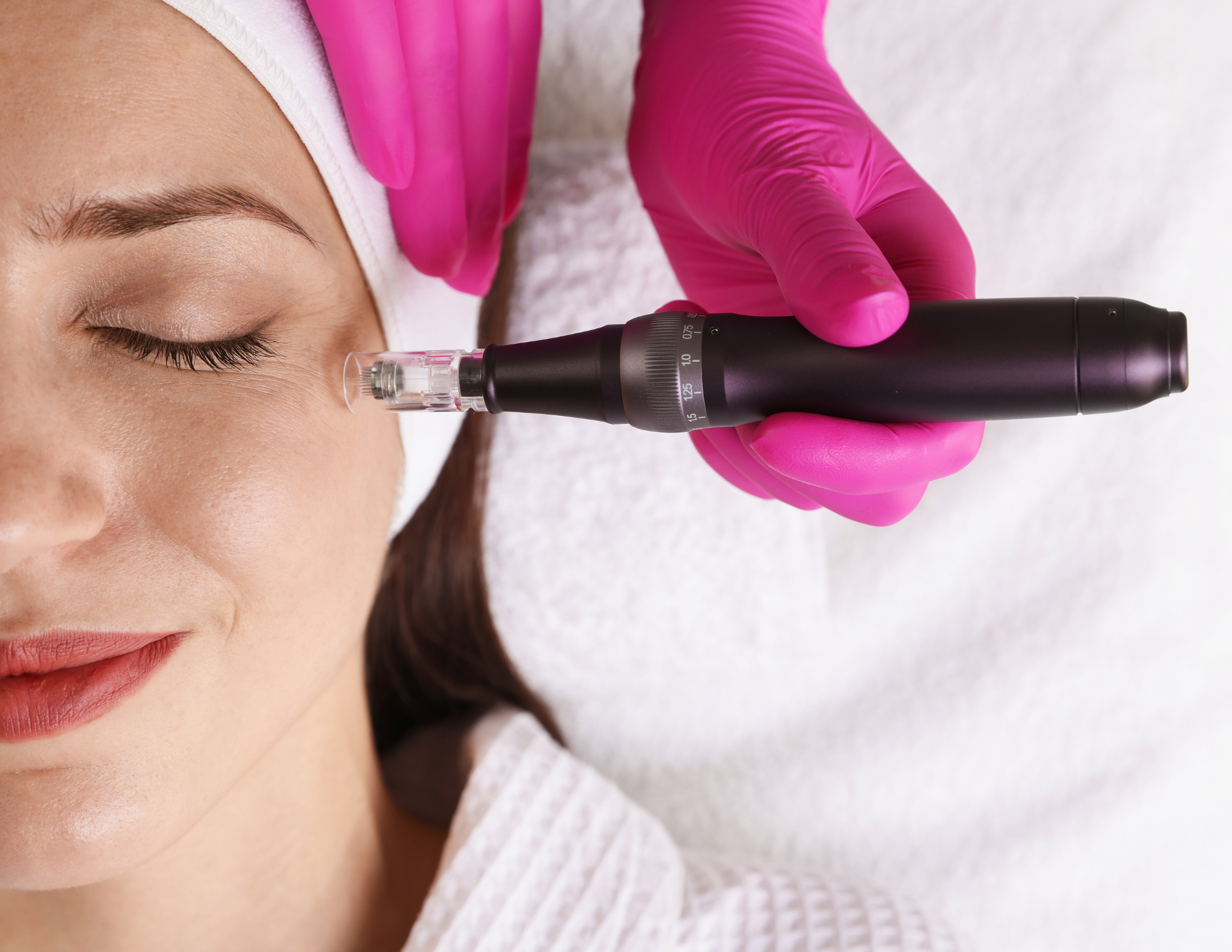Medspa in Orange, CA 92868 l Microneedling Near Me