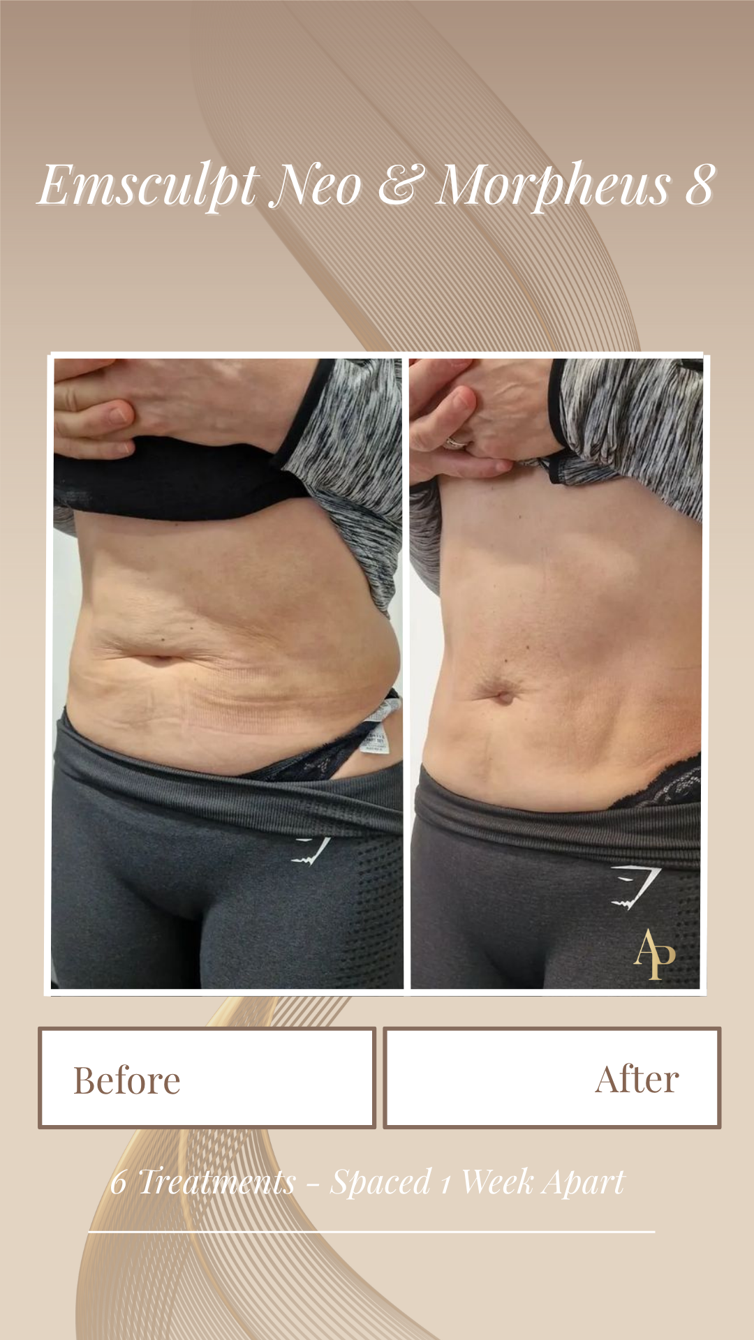 Body.zip - 7.PNG