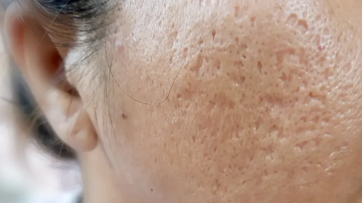 scars.webp