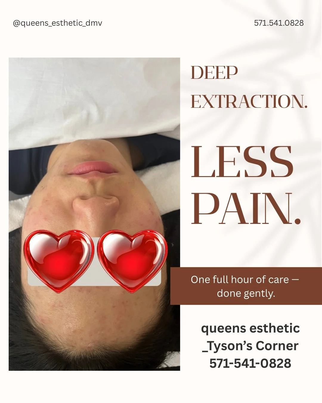 Less pain, deeper care. Why our extraction feels different? Deep acne care doesn&rsquo;t have to hurt. Many acne clients tell us the same thing:
&ldquo;Extraction is too painful &mdash; I can&rsquo;t handle more than 10&ndash;15 minutes.&rdquo;

At Q