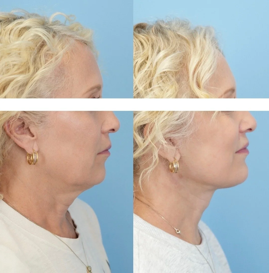 Untitled design - 3.JPEG