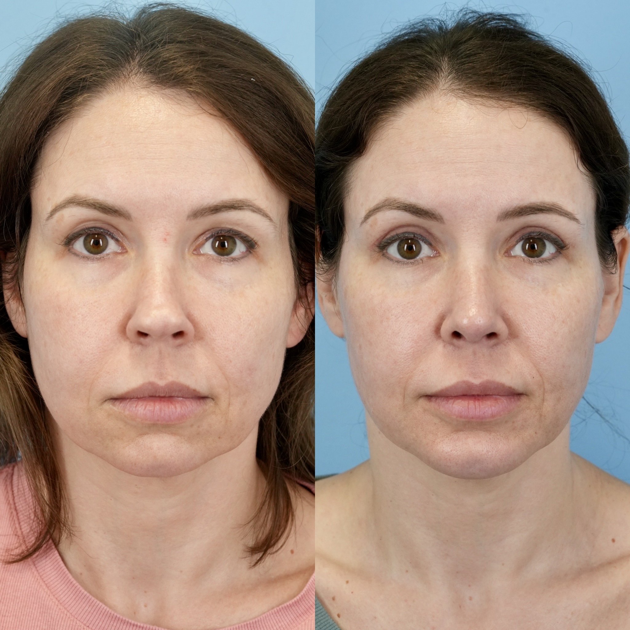 3A963FAA-44E8-4FDD-80D9-17F32F5CCDD1.jpg