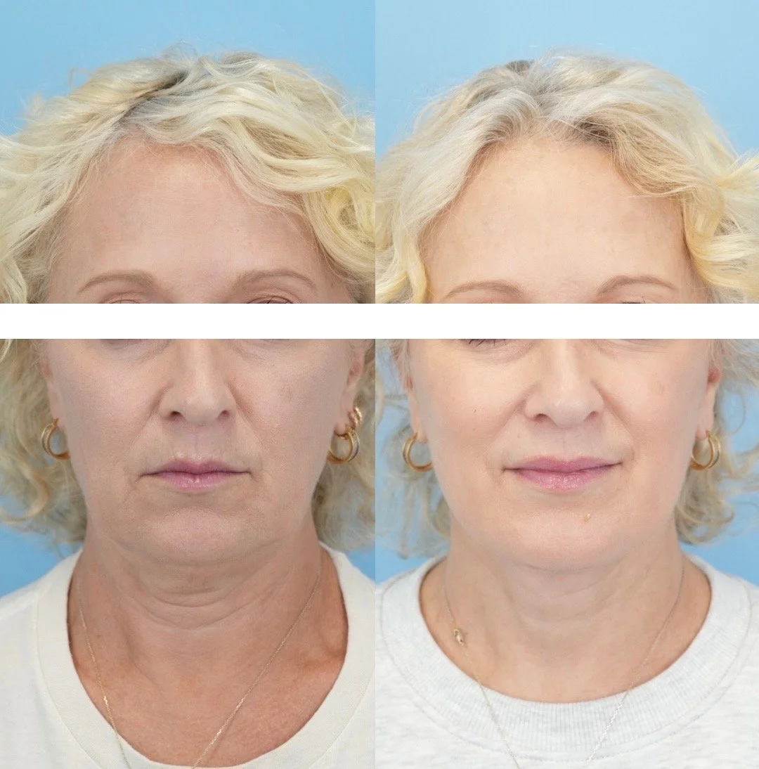 Untitled design - 4.JPEG