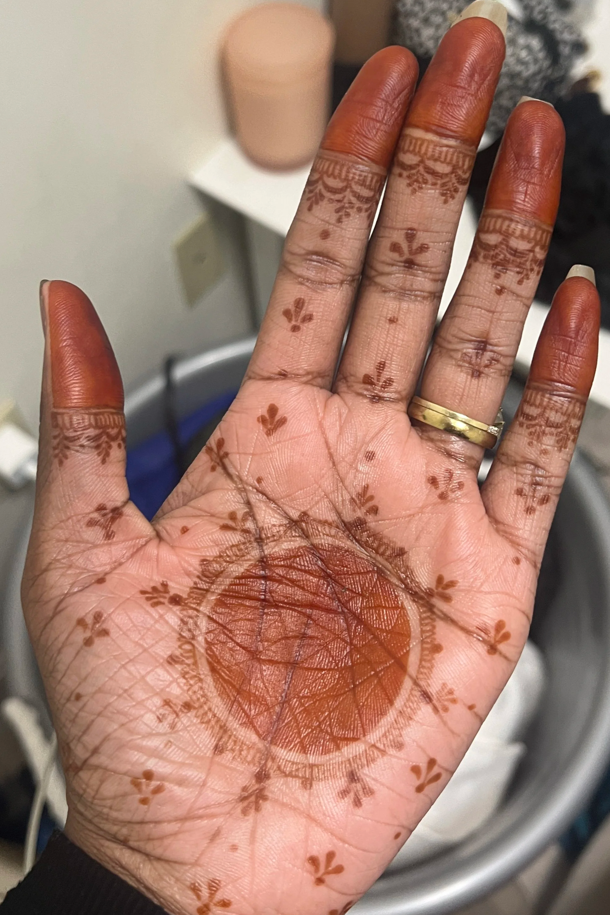 12-24hrs Post-Removal