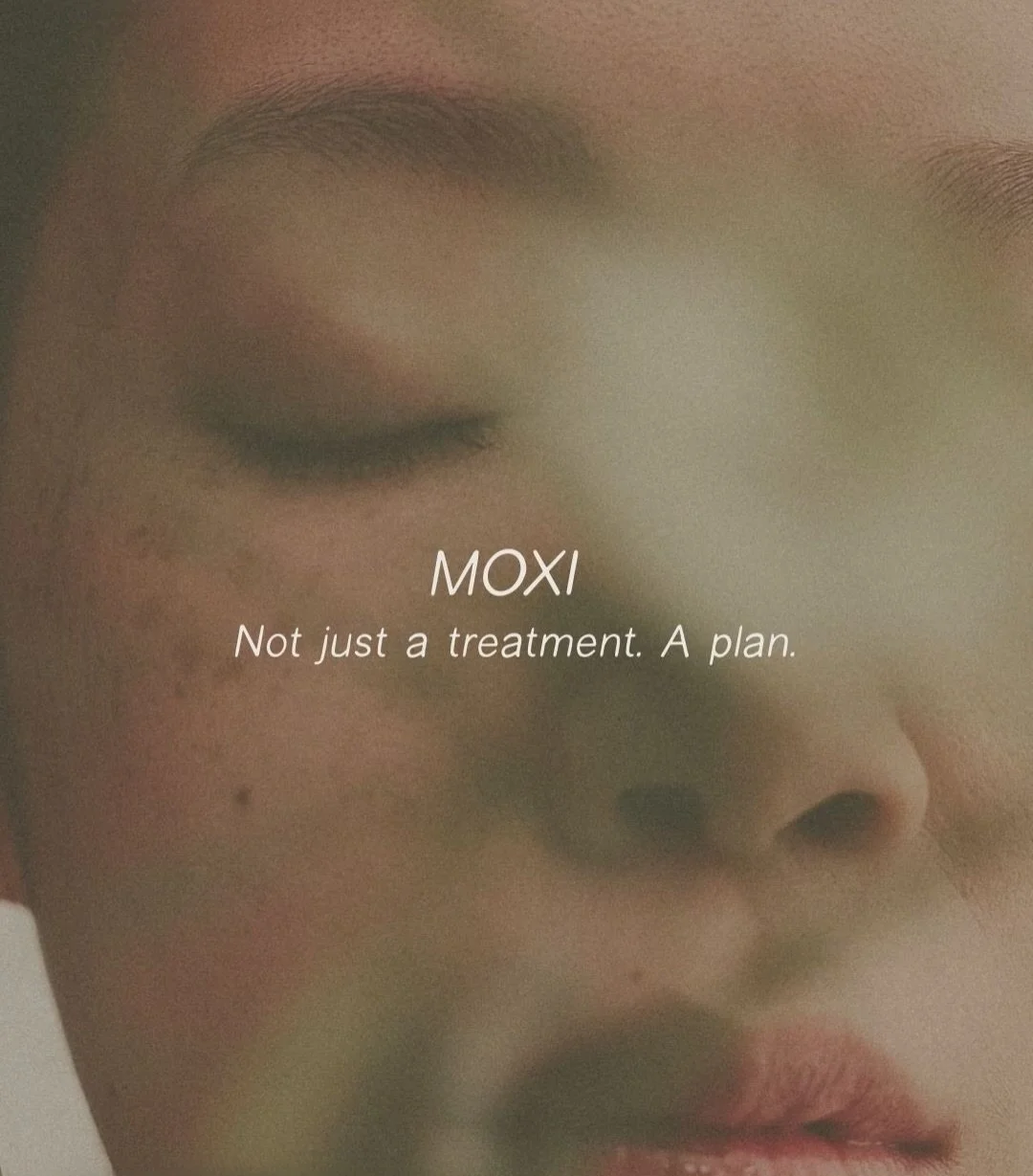 Now available at Alair
Your skin plan starts here.
Book Moxi through the link in bio. 🔗