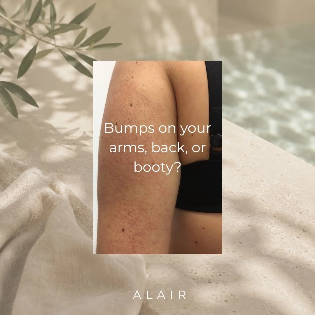 Summer skin starts with what you treat, not what you cover.

Rough arms. Back breakouts. Congested pores. Post-breakout marks.

These are some of my go-to clinical picks when skin needs real correction, not hype.

Available to shop through Alair ✨