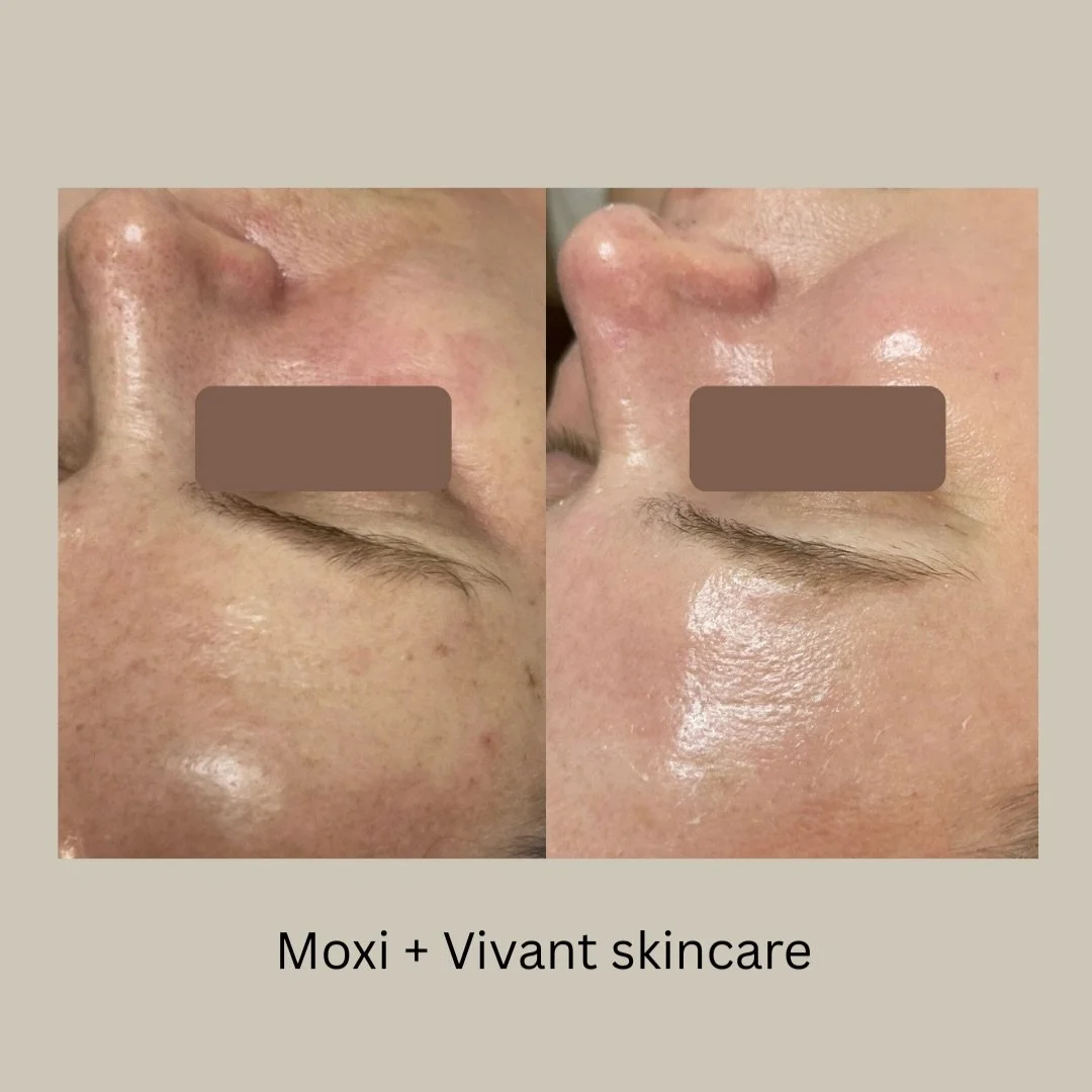 Moxi + Vivant Skincare. ✨

Ready to get started? Shop the VIVANT collection on our website and find the products your skin has been waiting for. 🤍