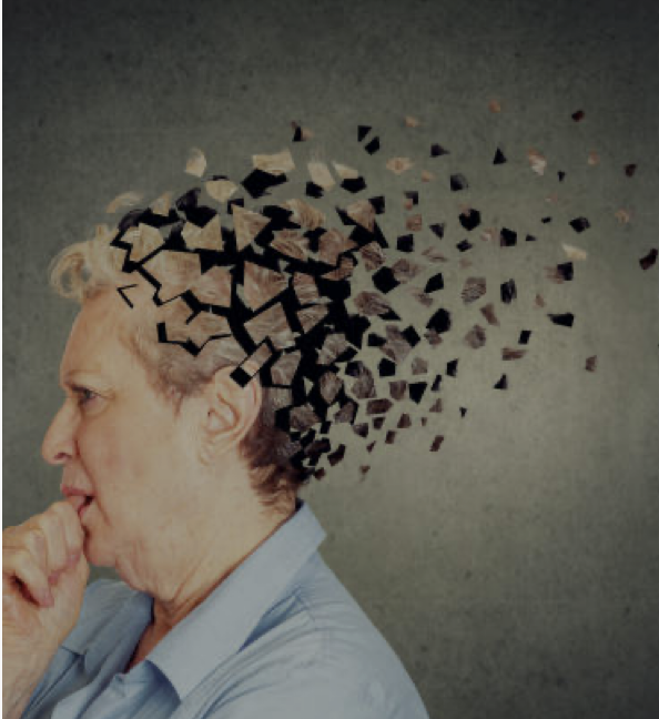 Kadınların beyninde gizli bir iz: Alzheimer ve Omega-3 bağlantısı