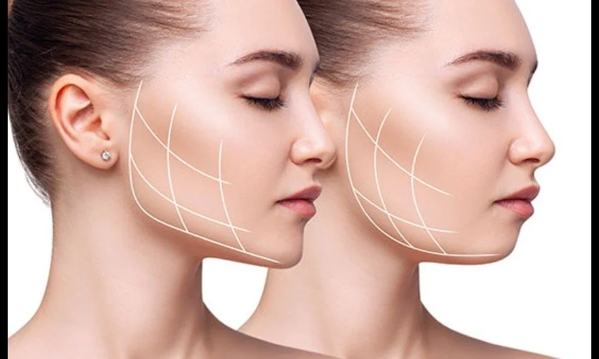 Plastik cerrahlar uyardı: "Botoks ve dolgu işlemlerinde ehil olmayan ellere dikkat"