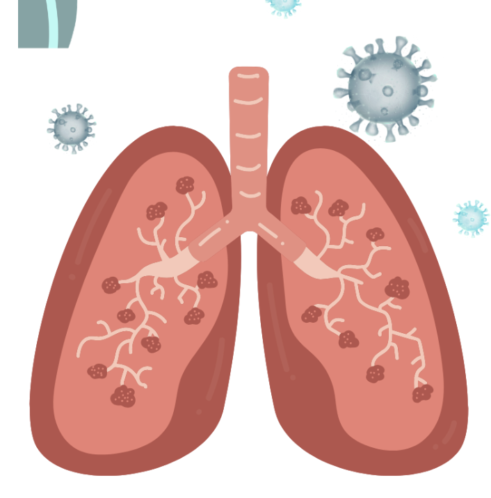 The Gut-Lung Axis: How Gut Health Shapes Immune Function and Respiratory Health