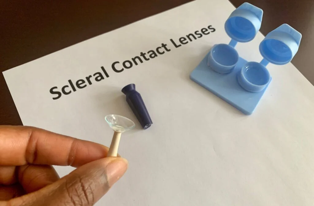 What Are Scleral Lenses? In Flushing, NY