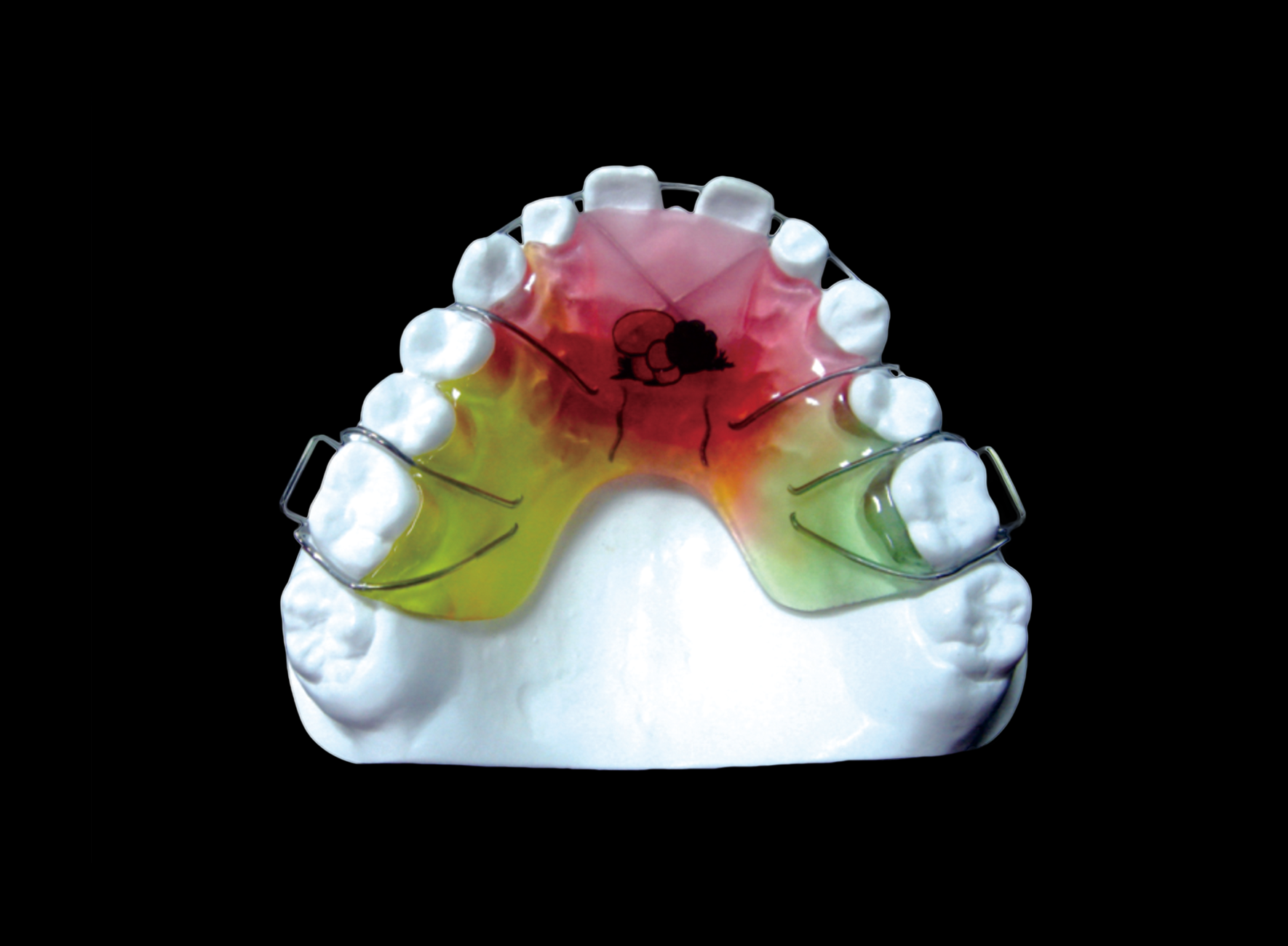 Hawley’s Retainer