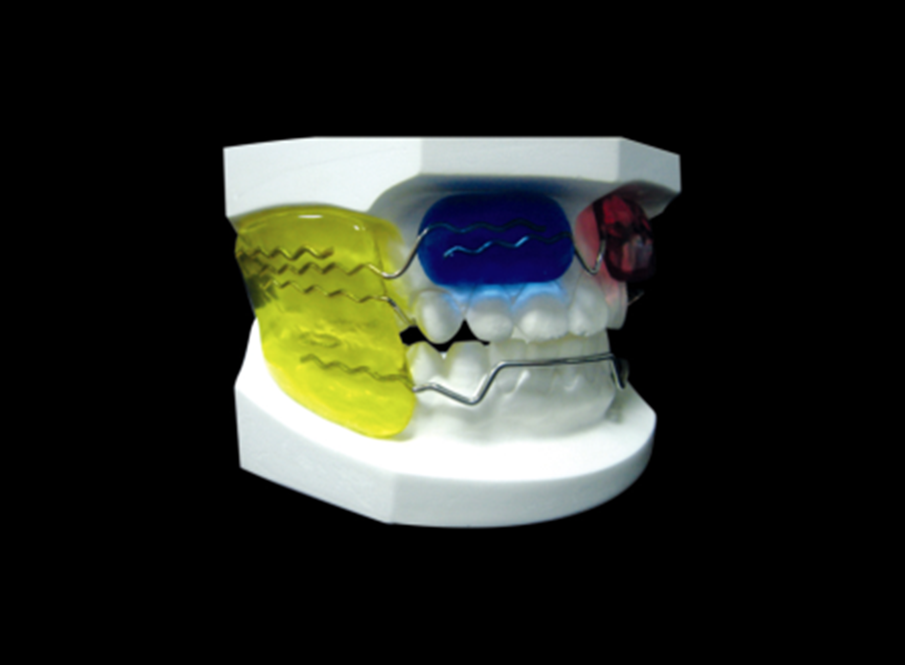 Functional Appliance (Frankel)