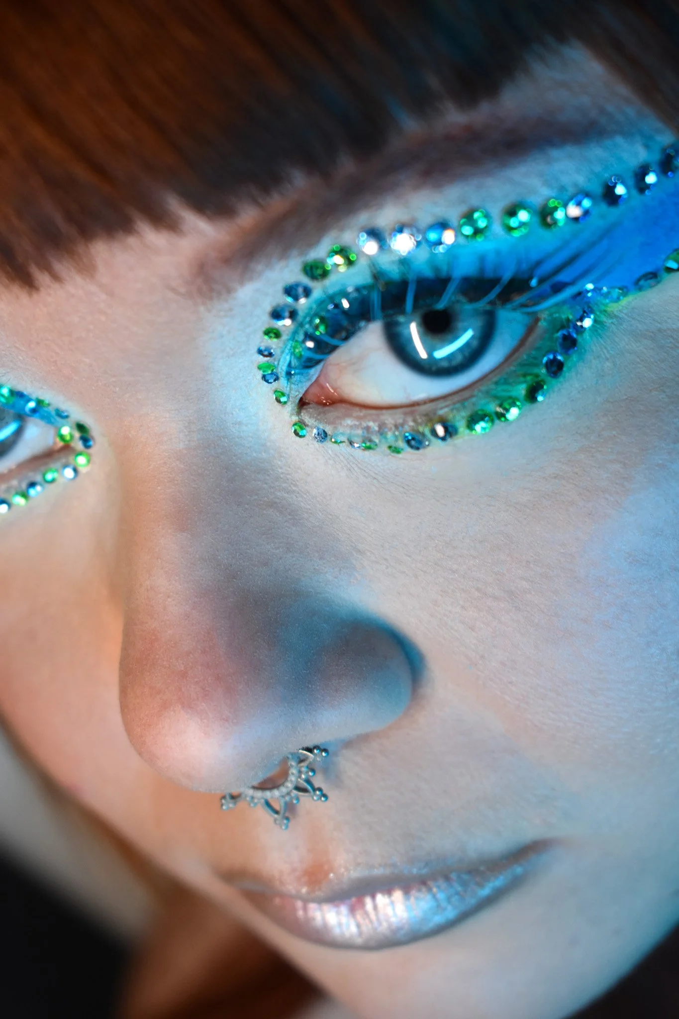 Tendinites 2 proche.jpg