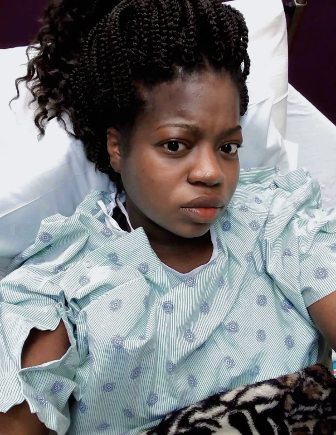 A woman lying in a hospital bed, looking directly at the camera, with a hospital gown and pillow visible.