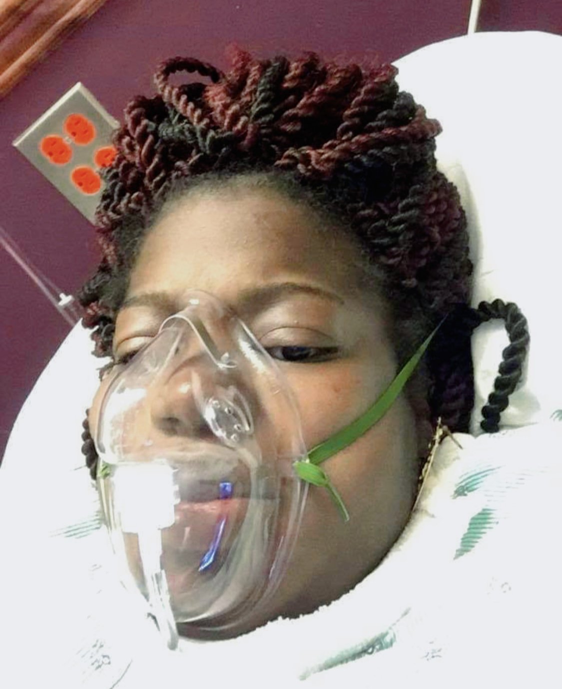 A woman lying in a hospital bed with an oxygen mask over her face, wearing a hospital gown and having braided hair.