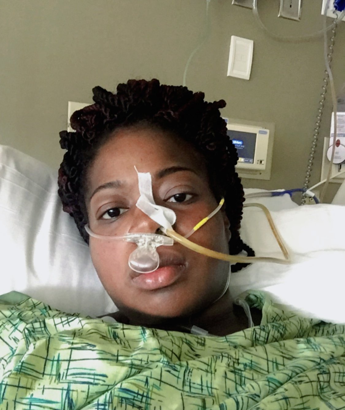 A woman lying in a hospital bed with medical tubes and tape on her face, wearing a patterned hospital gown, with monitors and medical equipment in the background.