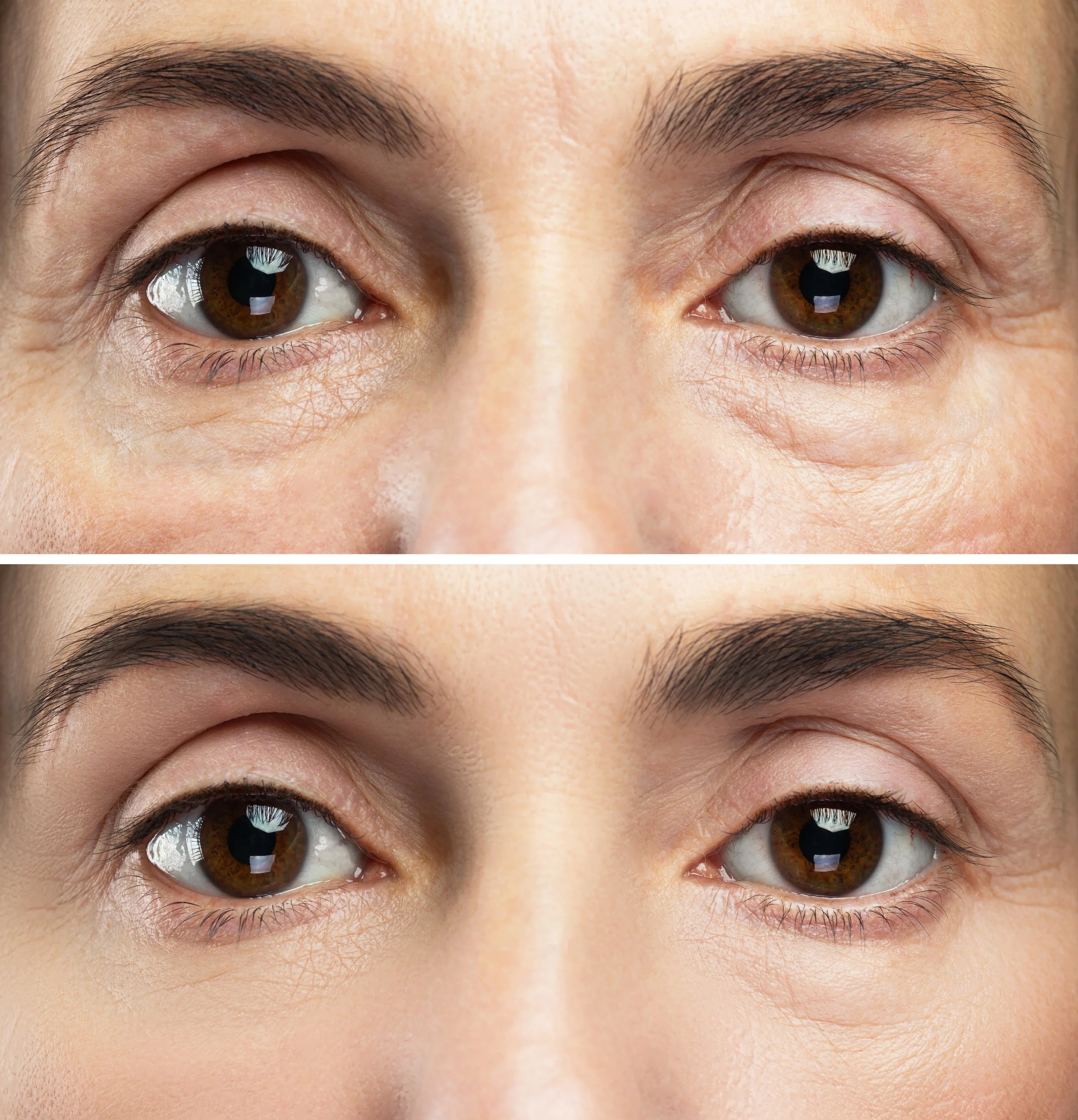 Medspa in Tempe, AZ, 85284  Botox Near Me