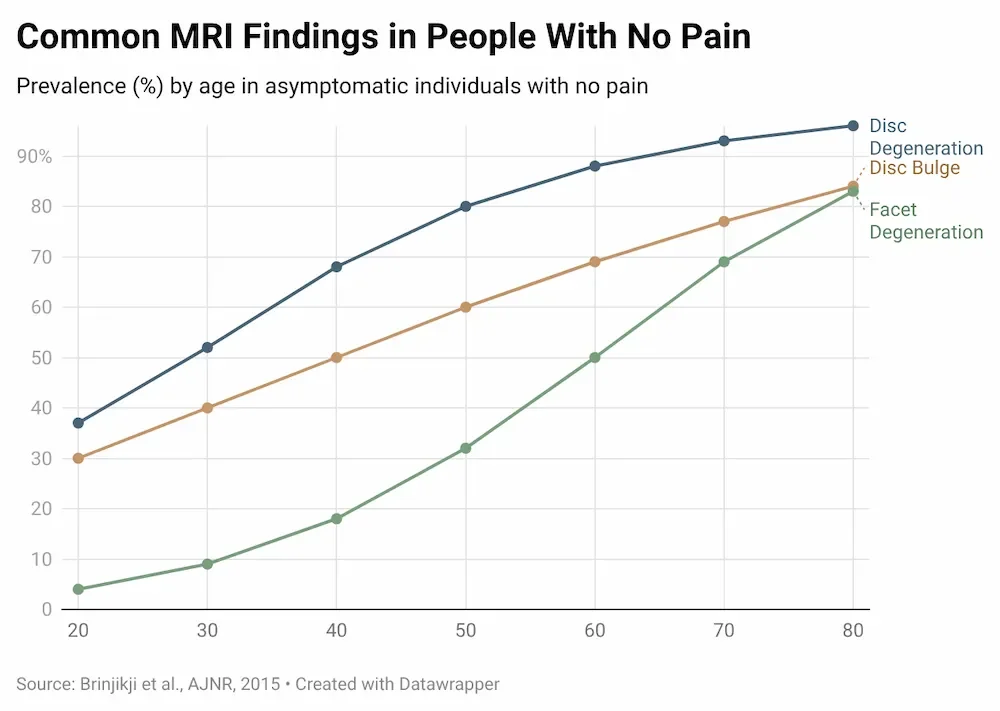 Line graph showing MRI findings in asymptomatic individuals by age. Disc degeneration rises from 37% at age 20 to 96% at age 80. Disc bulge from 30% to 84%. Facet degeneration from 4% to 83%. Source: Brinjikji et al. AJNR 2015.