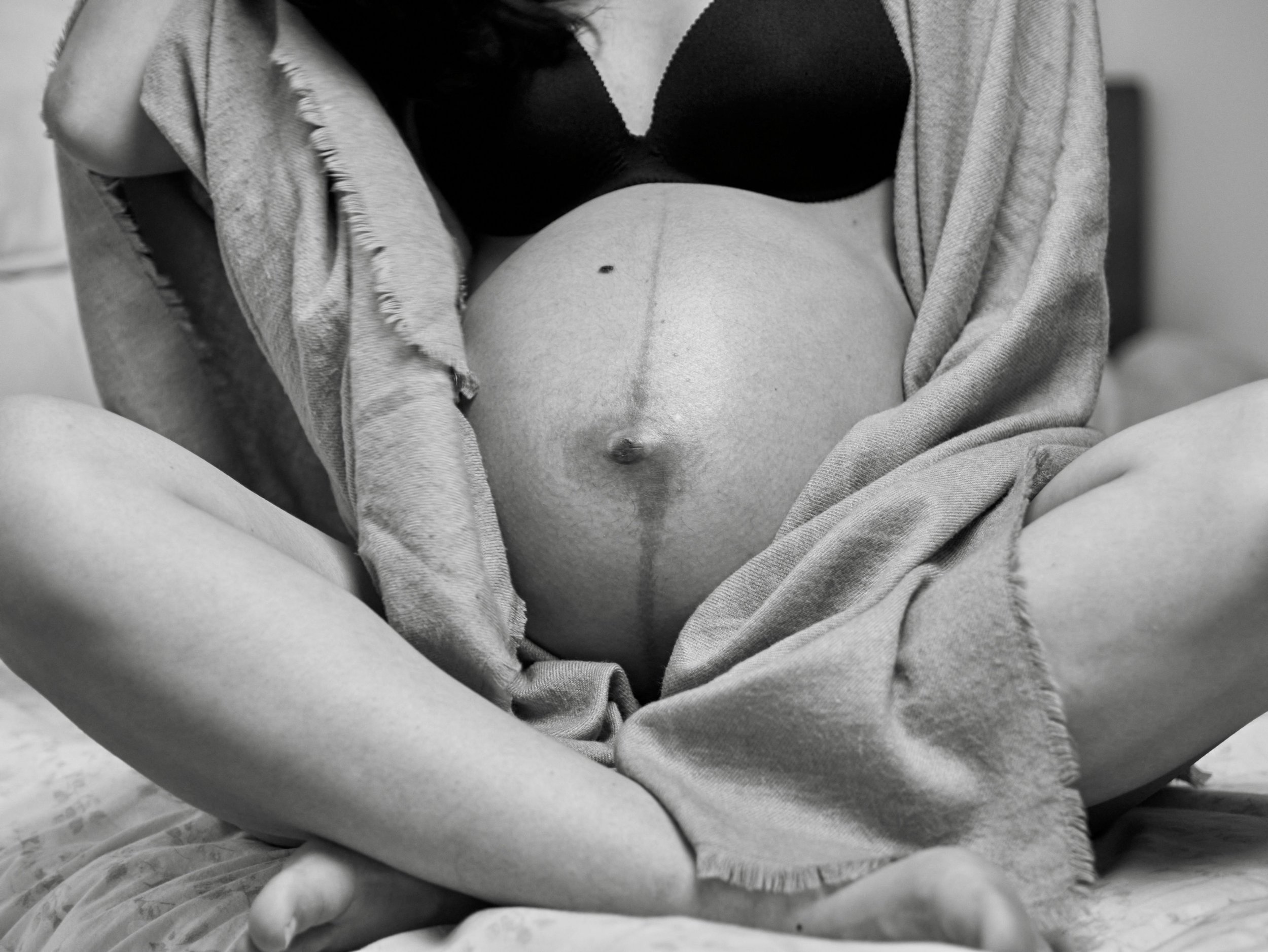 What Is Diastasis Recti? A Pelvic Health Physical Therapist Explains