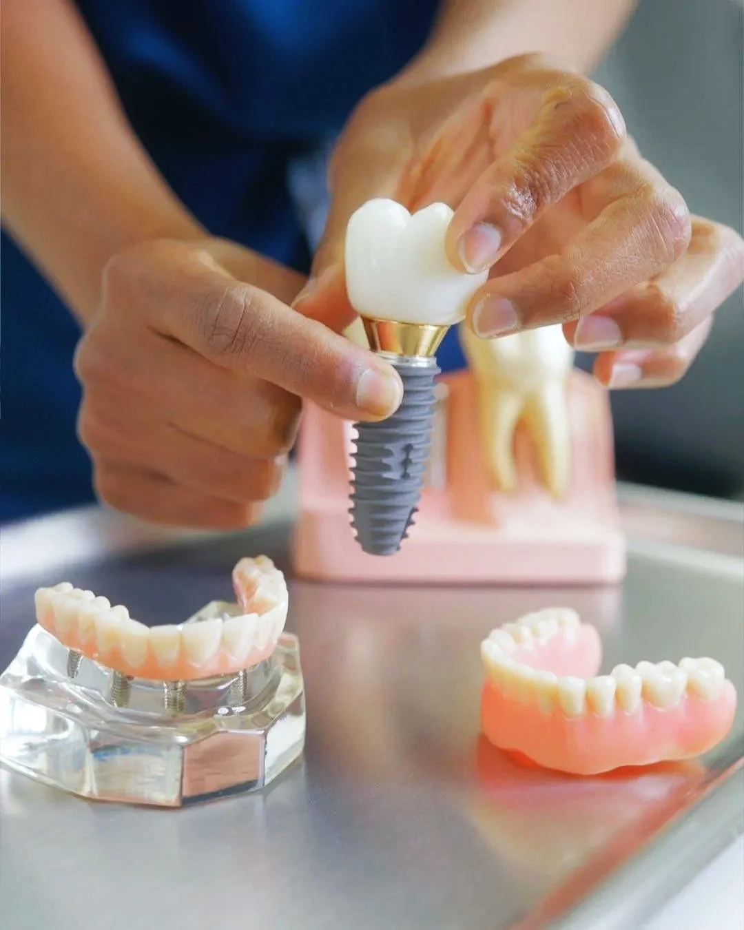 A person handling a dental implant with a tooth on top, with dentures and a dental model on the table.